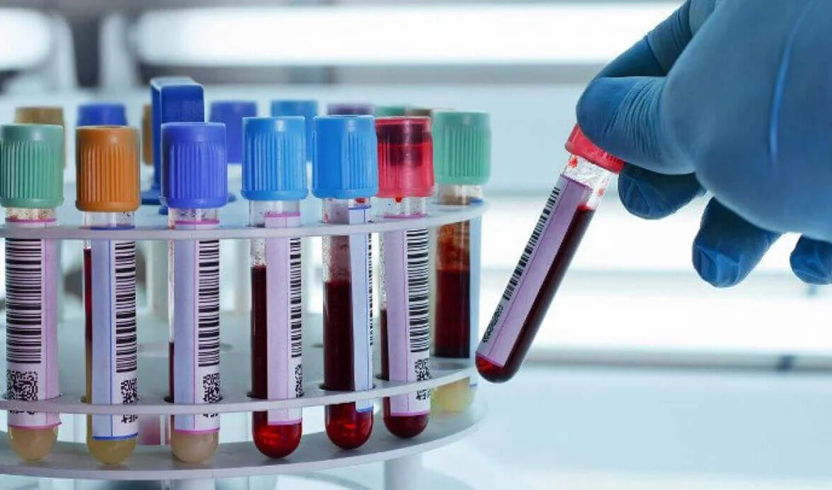 فلوراید تراپی