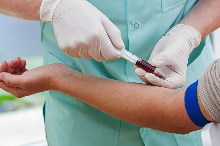 ارتودنسی با الاینرها